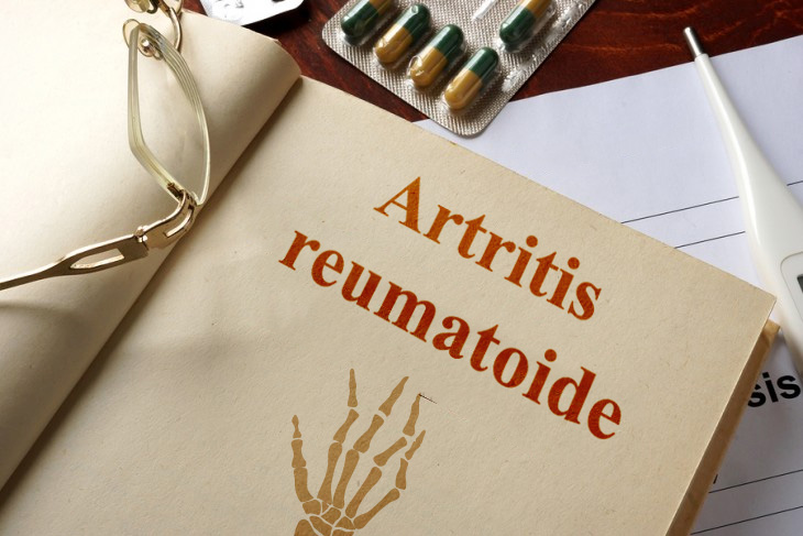 Artritis reumatoide