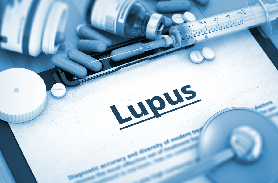 Lupus